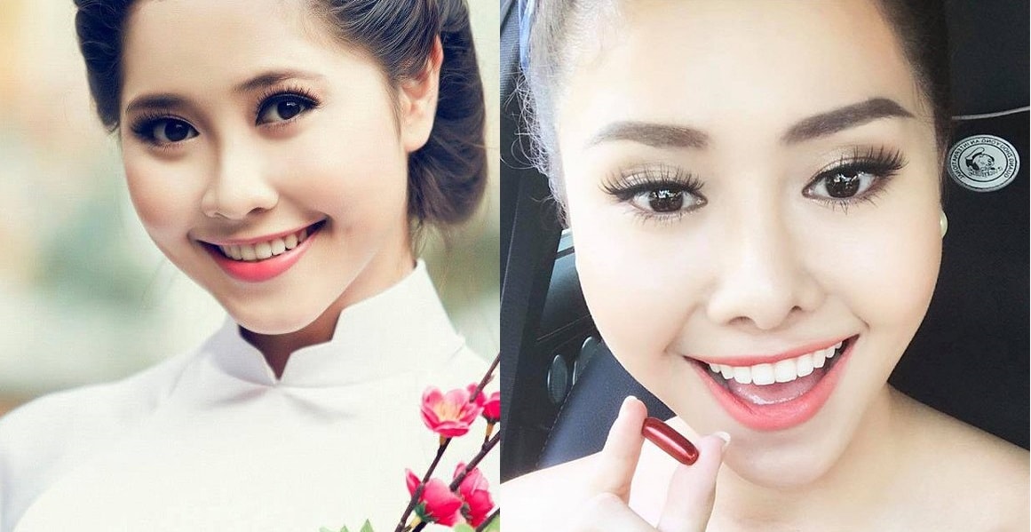 Xuất hiện với chiếc mũi biến dạng méo mó, nữ diễn viên Tường Vi khiến fan phát hoảng